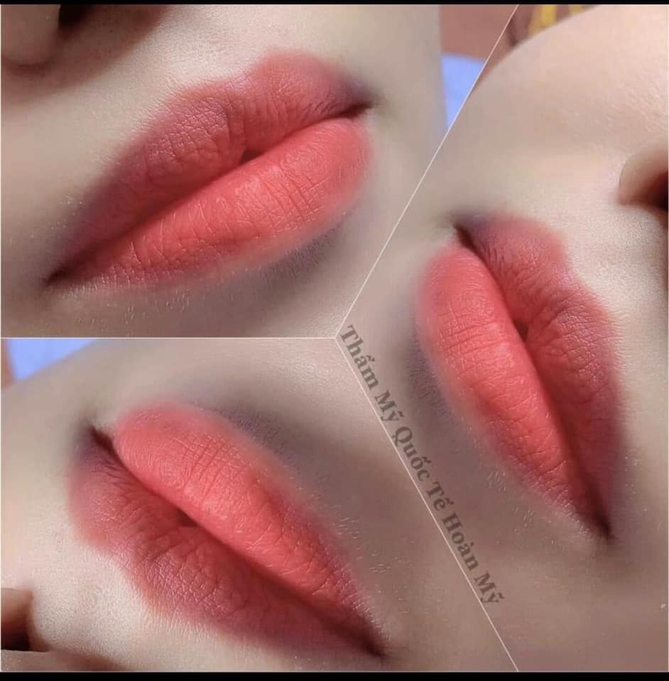 thẩm mỹ viện tại ninh thuận thẩm mỹ viện tại ninh thuận